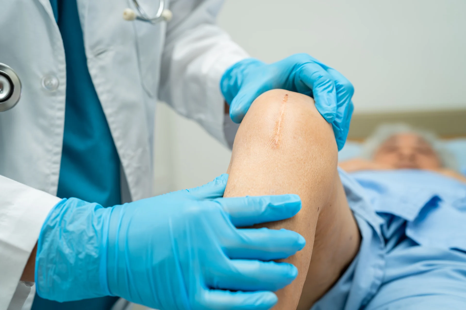 asian-elderly-woman-patient-show-her-scars-surgica-2025-02-25-01-33-45-utc